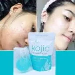 Kojic Collagen Extreme Whitening Soap