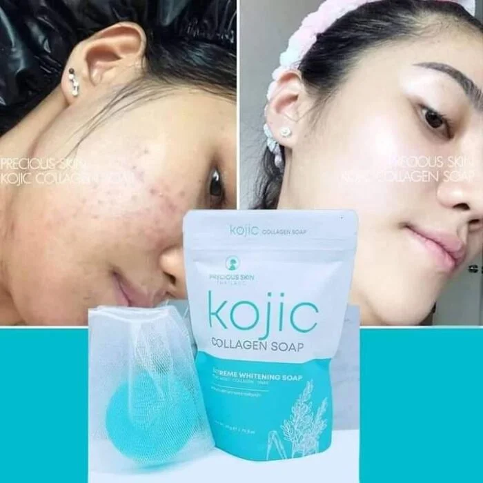 Kojic Collagen Extreme Whitening Soap