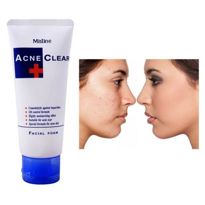 Mistine Acne Clear Facial Foam Mistine Acne Clear Facial Foam