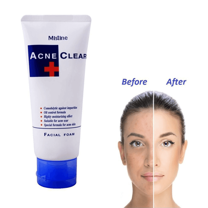 Mistine Acne Clear Facial Foam Mistine Acne Clear Facial Foam