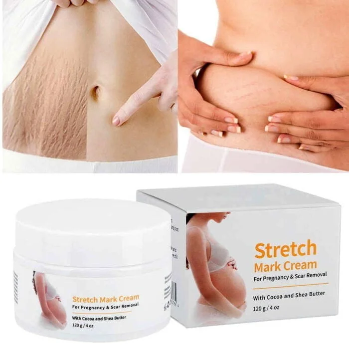 Melao Stretch Mark Cream