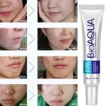 Bioaqua Acne Cream Scars Removal Face Cream