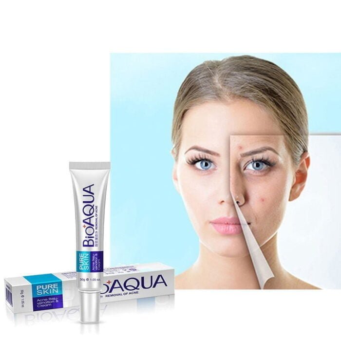 Bioaqua Acne Cream Scars Removal Face Cream
