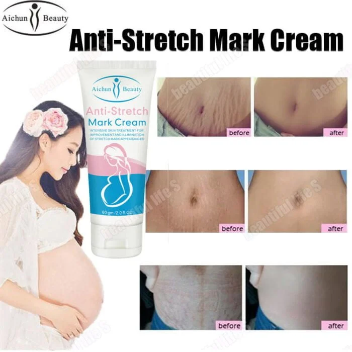 Aichun Beauty Anti Stretch Mark Cream
