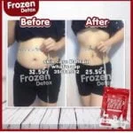 Frozen Detox 2 in 1 Slimming Capsule