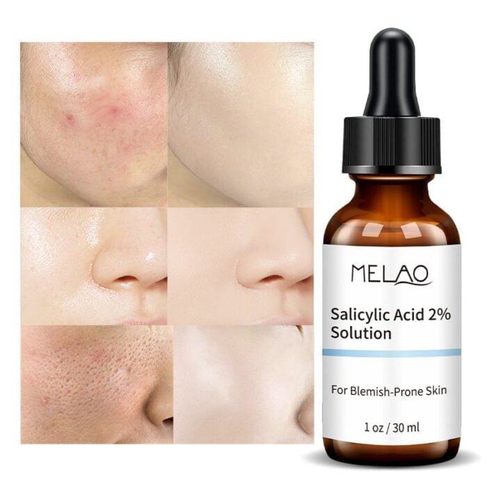 Melao Salicylic Acid 2% Solution Melao Salicylic Acid 2% Solution