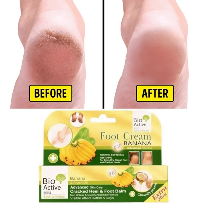 Bio Active Bannana Foot Cream