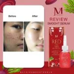 Red Gem Mix Beetroot Serum