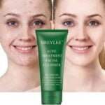 Breylee Acne Treatment Facewash