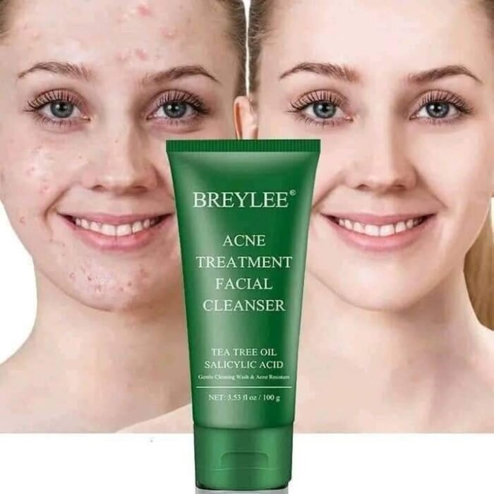 Breylee Acne Treatment Facewash Breylee Acne Treatment Facewash