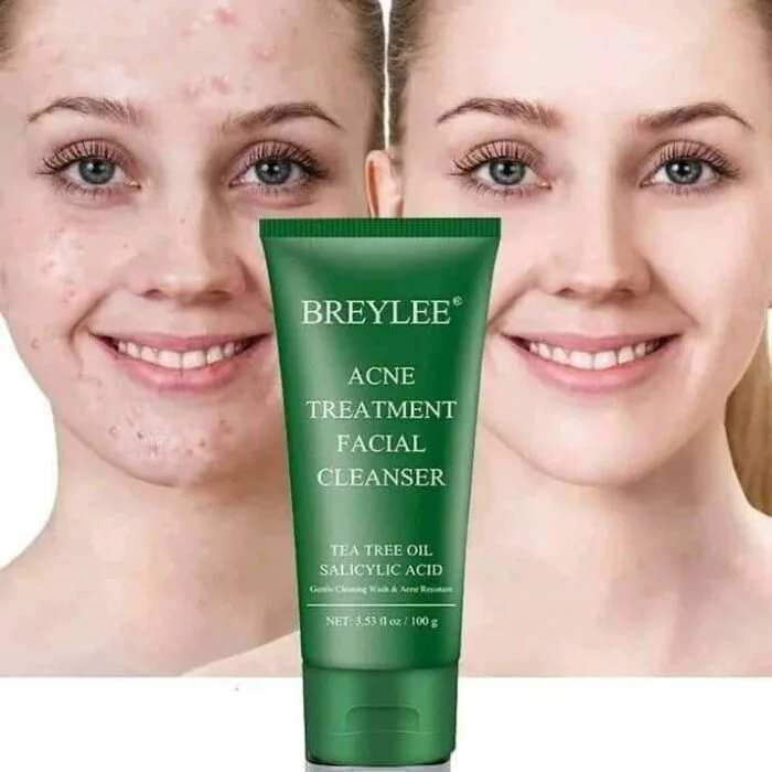 Breylee Acne Treatment Facewash