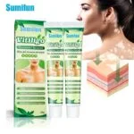 Sumifun Vitiligo Cream