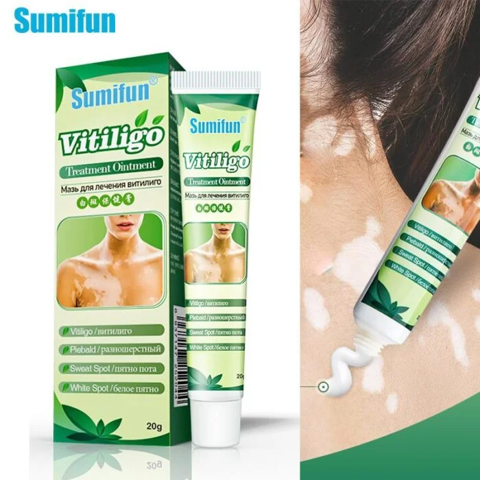 Sumifun Vitiligo Cream