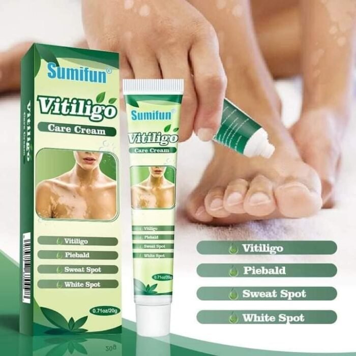Sumifun Vitiligo Cream