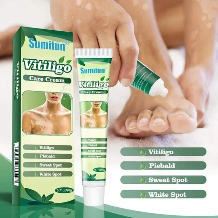 Sumifun Vitiligo Cream