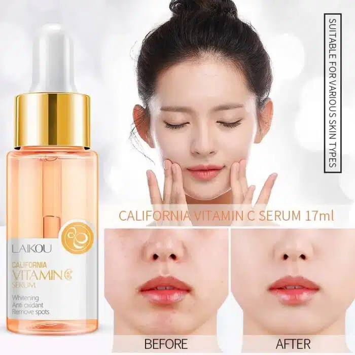 LAIKOU Vitamin C Brightening Serum