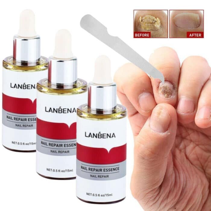 Lanbena Nail Repair Essence Lanbena Nail Repair Essence