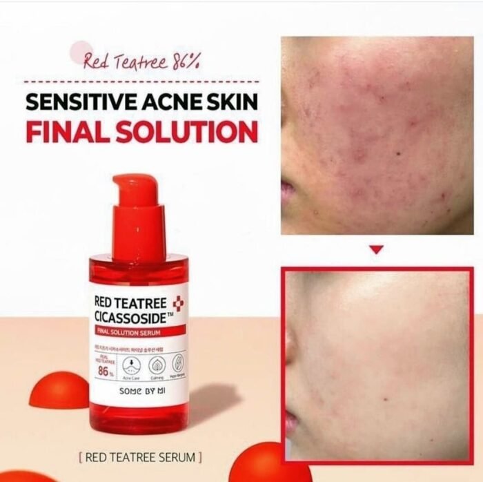 Red Teatree Cicassodide Final Solution Serum Red Teatree Cicassodide Final Solution Serum