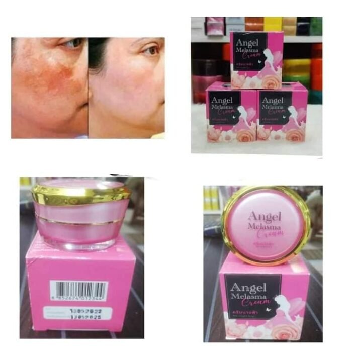 Angel Melasma Cream