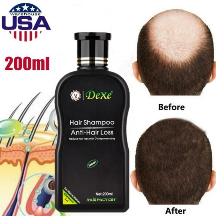 Dexe Hair Shampoo Anti Hair Loss Dexe Hair Shampoo Anti Hair Loss