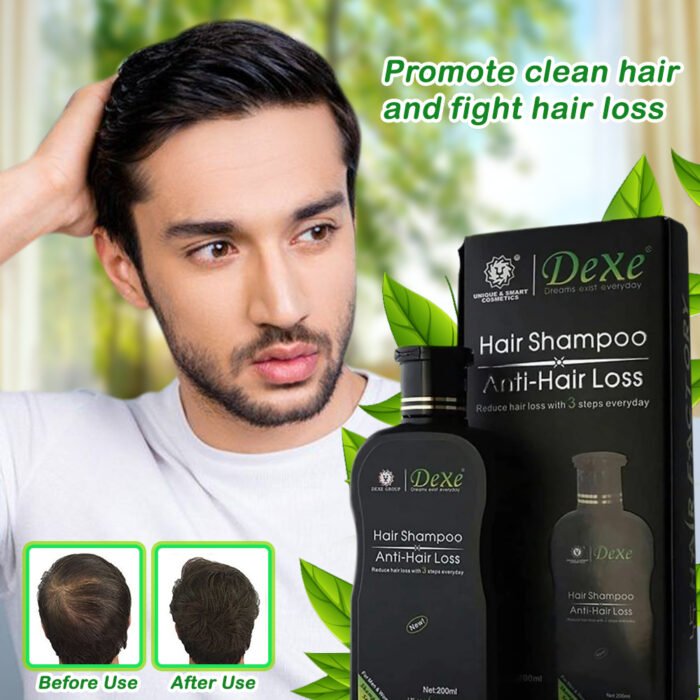 Dexe Hair Shampoo Anti Hair Loss Dexe Hair Shampoo Anti Hair Loss