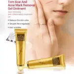 TCM Scar Acne Mark Removal Gel Ointment