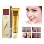 TCM Scar Acne Mark Removal Gel Ointment