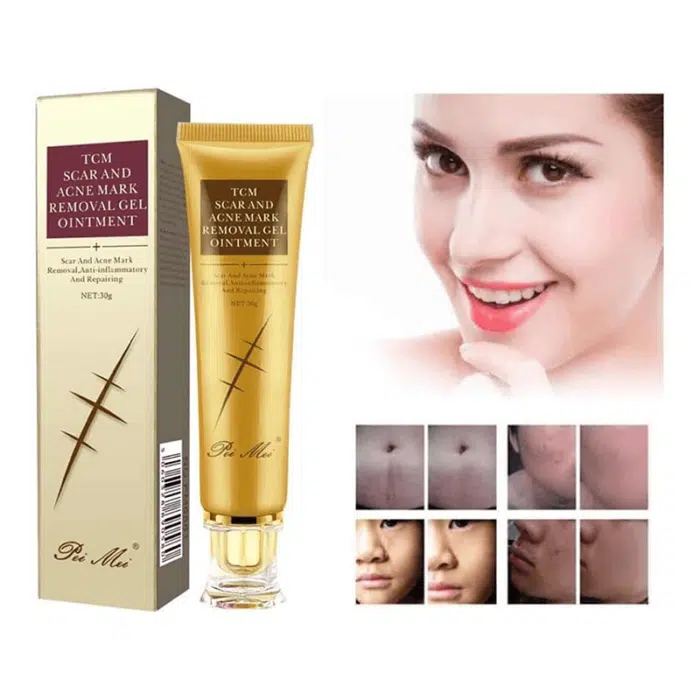 TCM Scar Acne Mark Removal Gel Ointment