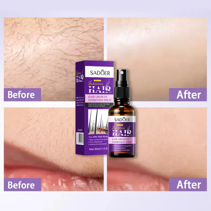 Sadoer Natural Inhibitor Hair Serum Sadoer Natural Inhibitor Hair Serum