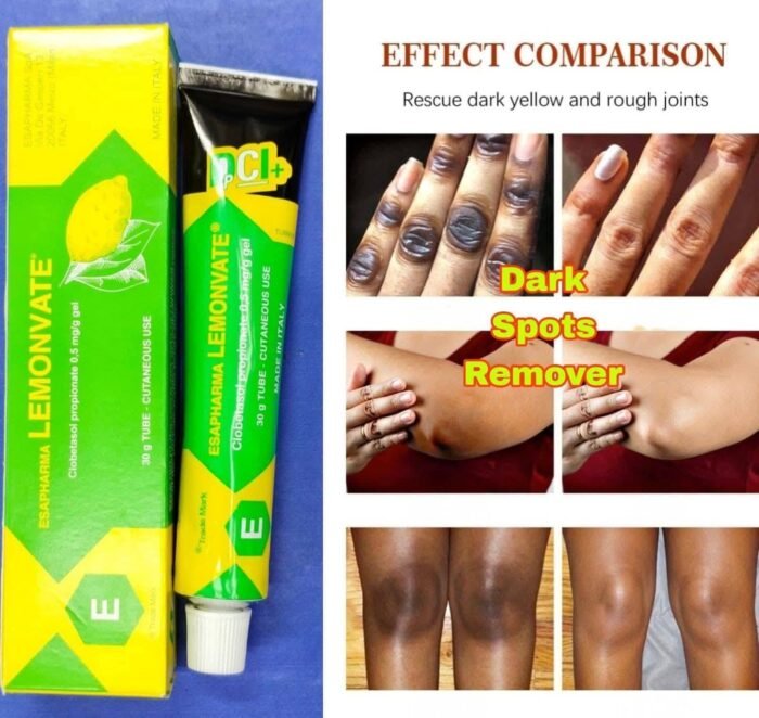 Lemonvate Cream Lemonvate Cream