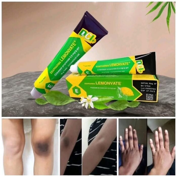 Lemonvate Cream Lemonvate Cream