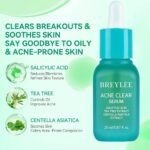 Breylee Acne clear Serum