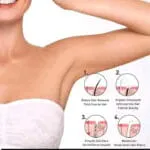 Hair Removal Kingyes Silky Beauty Spray